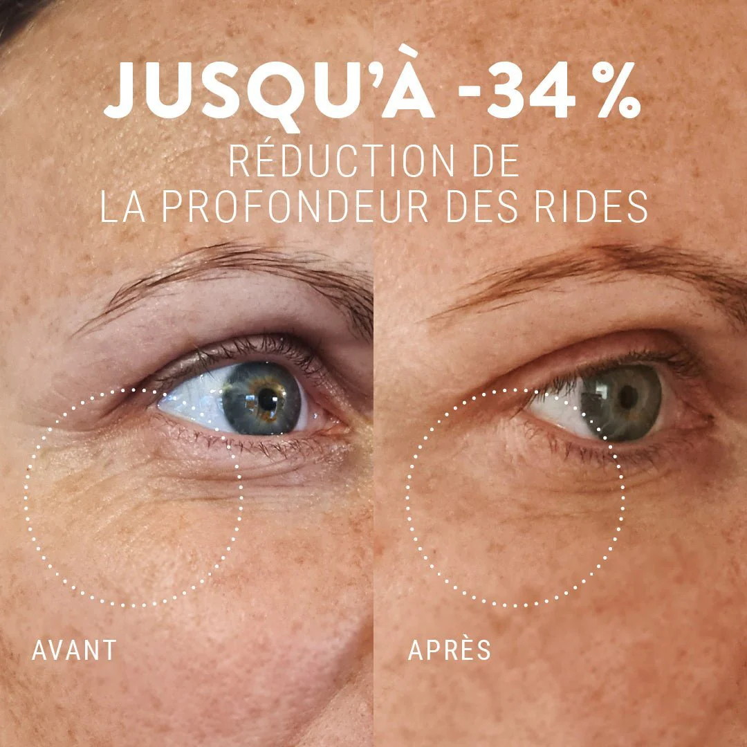 Soin contour des yeux anti cernes et rides | liftant 15ml - Image 4
